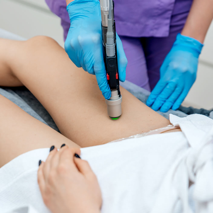 głębokie bikini, bikini do depilacji laserowej