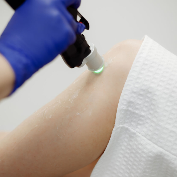 Depilacja laserowa nóg – co obejmuje