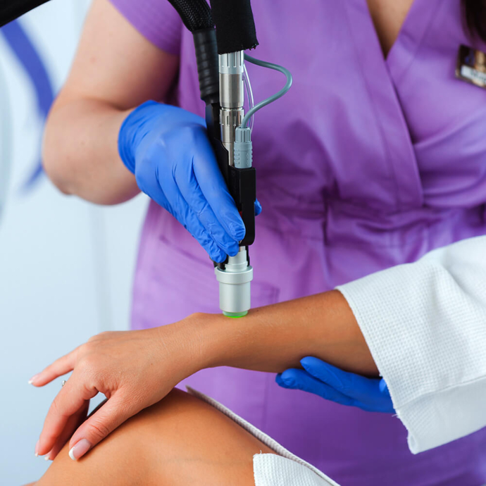 depilacja laserowa na rękach