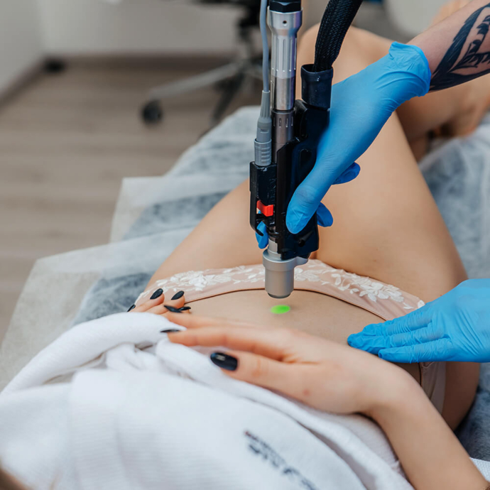 лазерна епіляція білої лінії живота