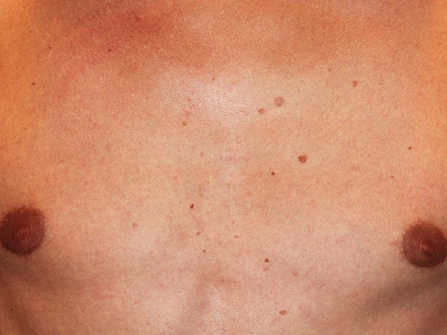 епіляція всього тіла ціна