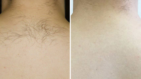 gallery laserville-05