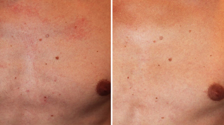 gallery laserville-06