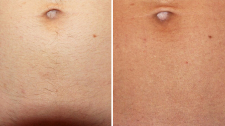 gallery laserville-09