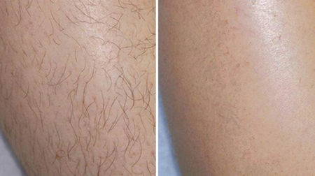 gallery laserville-12