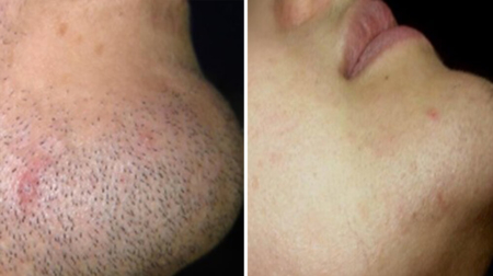 gallery laserville-17