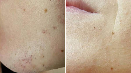 gallery laserville-18