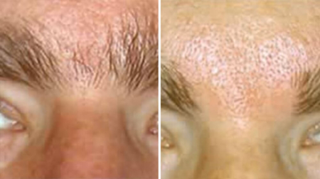 gallery laserville-20