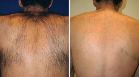 gallery laserville-22