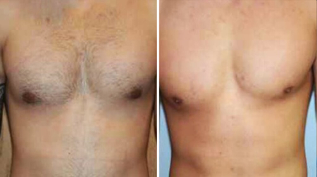 gallery laserville-25