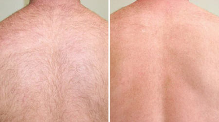 gallery laserville-26