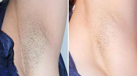 gallery laserville-32