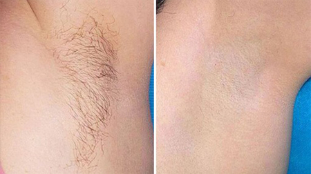 gallery laserville-34