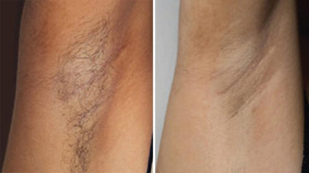 gallery laserville-35