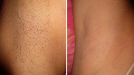 gallery laserville-36