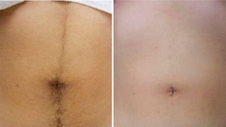 gallery laserville-38