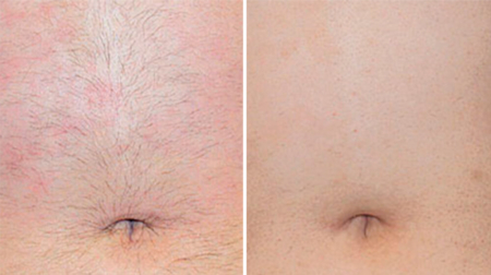 gallery laserville-40