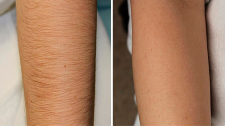 gallery laserville-41