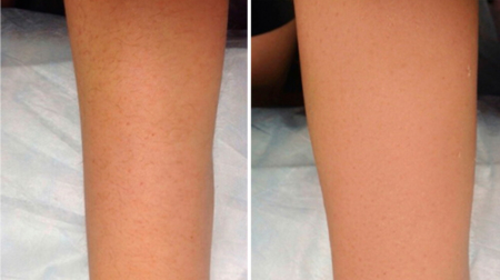 gallery laserville-42