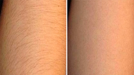 gallery laserville-43