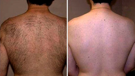 gallery laserville-44