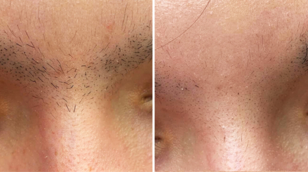 gallery laserville-48