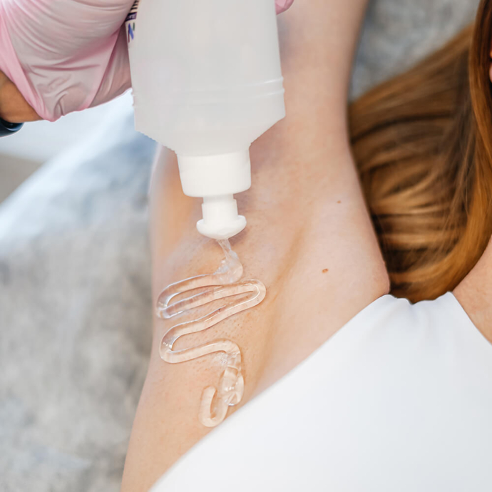 lazerna-epilyaciya-pahv-10