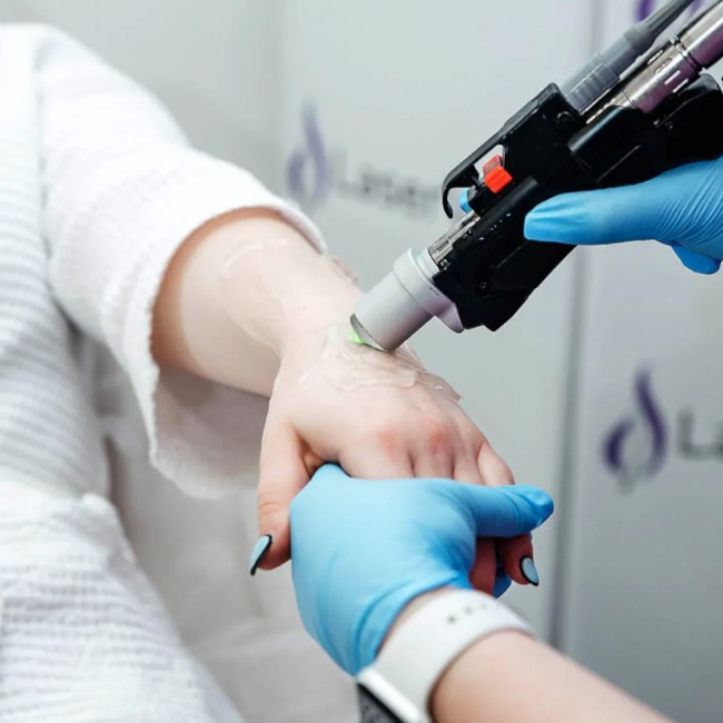 Which is better, ELOS or laser? Reviews