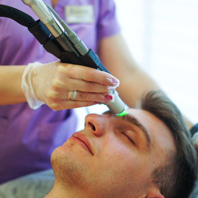 depilacja laserowa głowy u mężczyzn