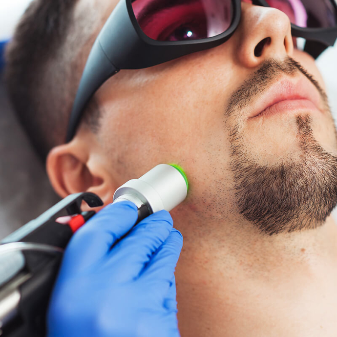 лазерна епіляція обличчя чоловіки