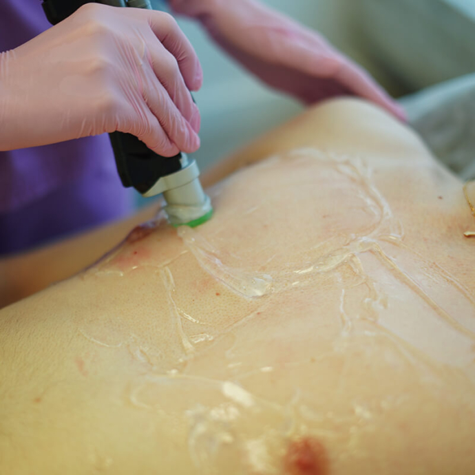 чоловіча лазерна епіляція грудей ціна