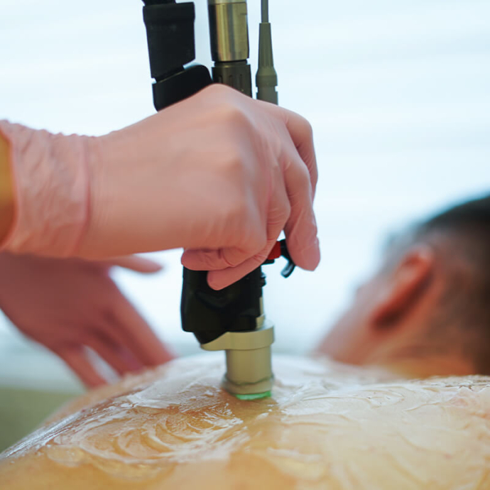 лазерна епіляція спини чоловіків відгуки