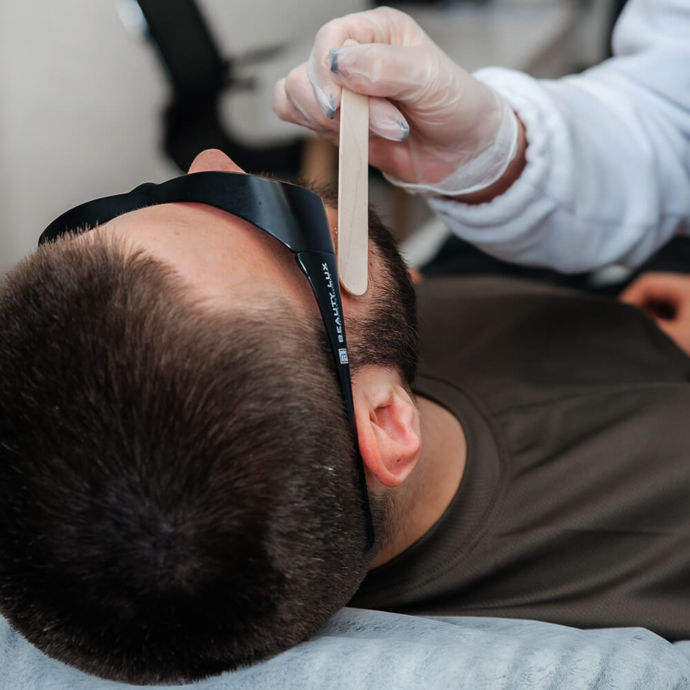 laserowe usuwanie włosów na głowie