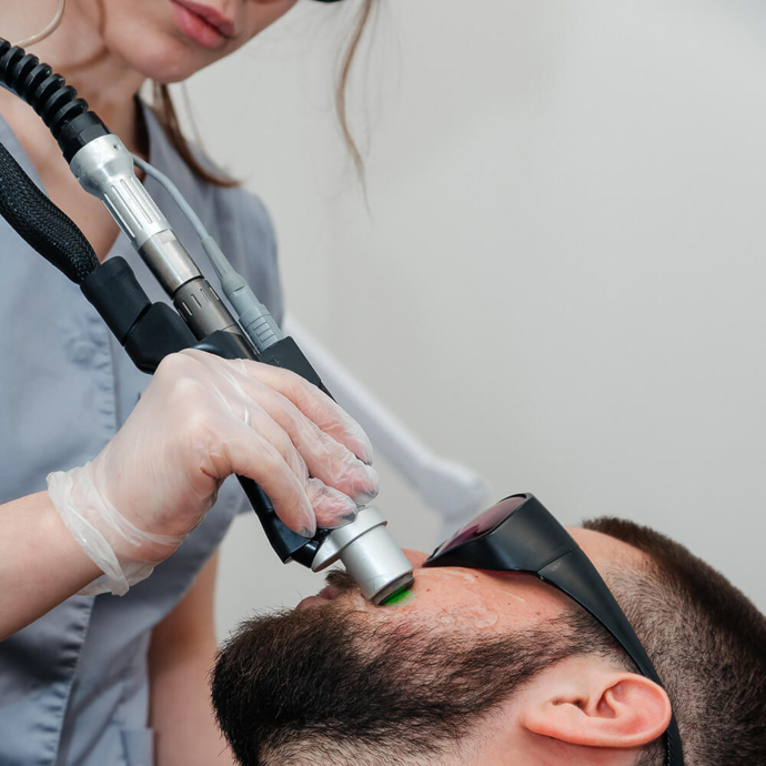 depilacja laserowa brody u mężczyzn opinie