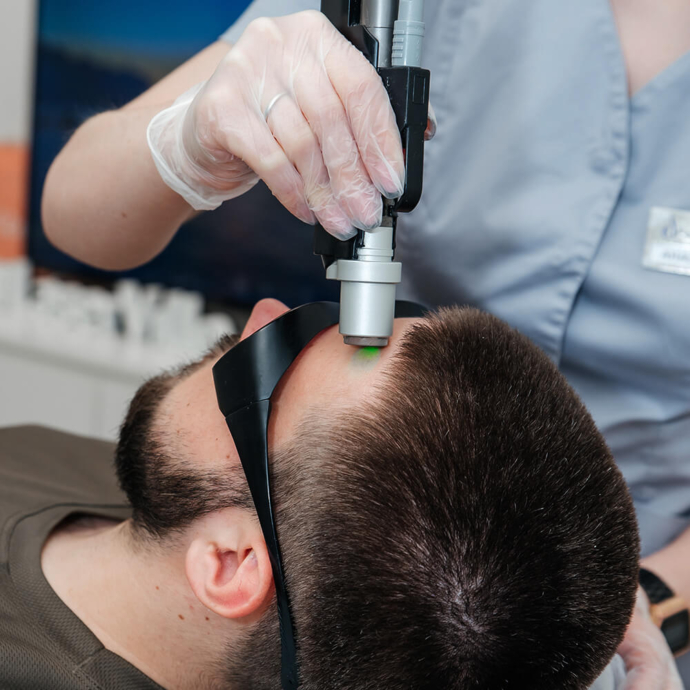 depilacja laserowa głowy dla mężczyzn