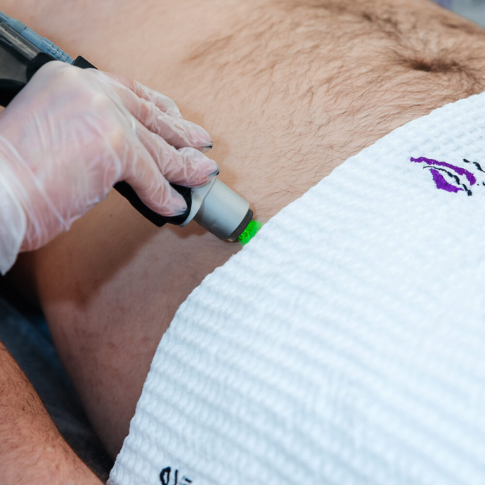 Men’s bikini laser hair removal in progress