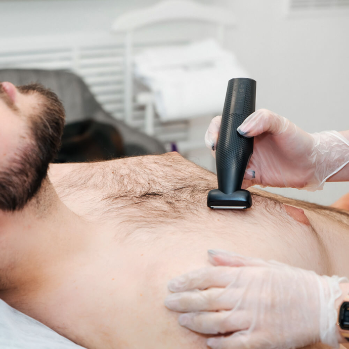 лазерна епіляція чоловіків по всьому тілу ціна