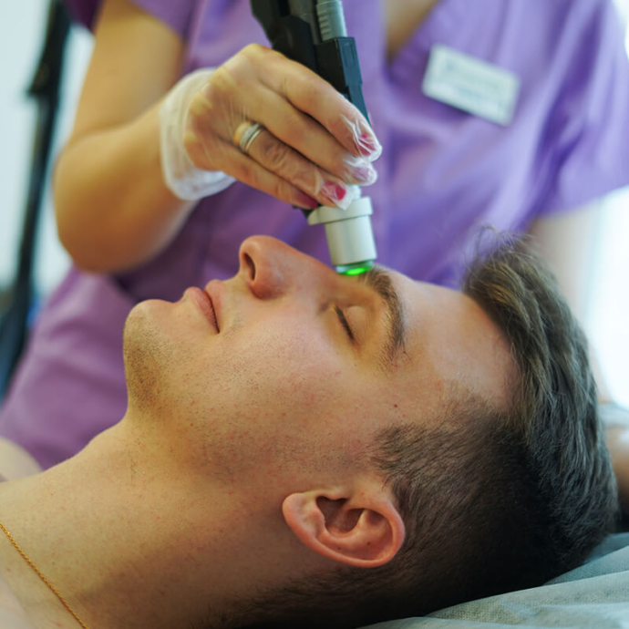 лазерна епіляція брів у чоловіків