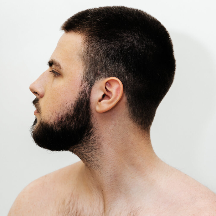 лазерна епіляція шиї чоловіка