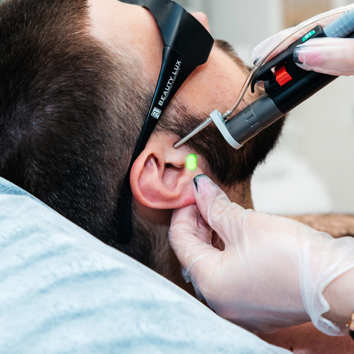 лазерна епіляція вух для чоловіків