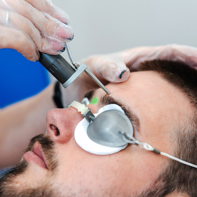 лазерна епіляція брів у чоловіків фото