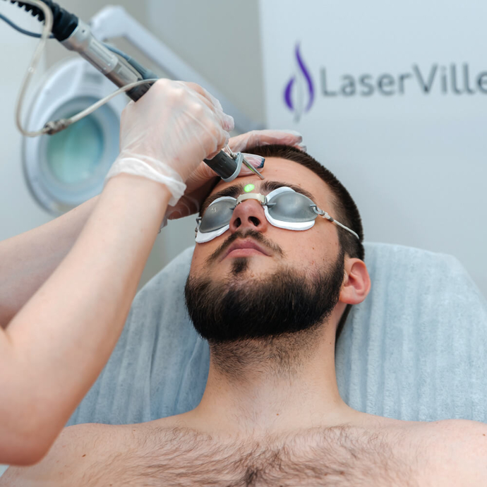 лазерна епіляція брів у чоловіків вартість