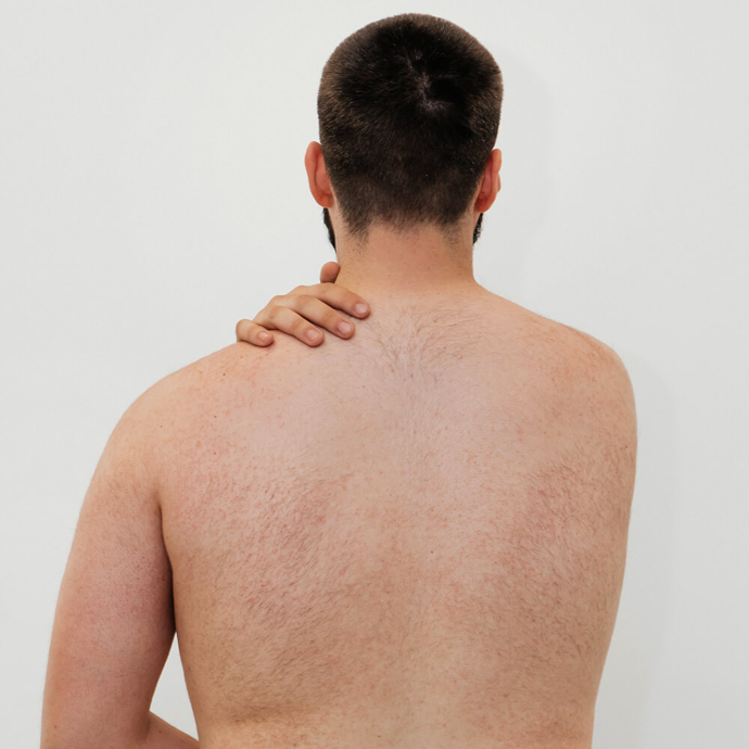 видалення волосся зі спини