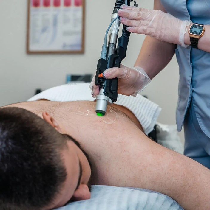 how does laser hair removal affect acne
