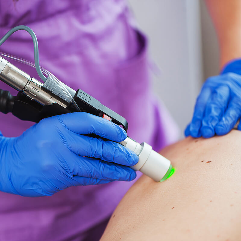 Education, experience, and professionalism of a laser hair removal specialist