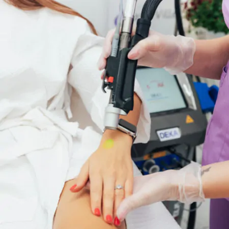 як обробляти лазер для епіляції