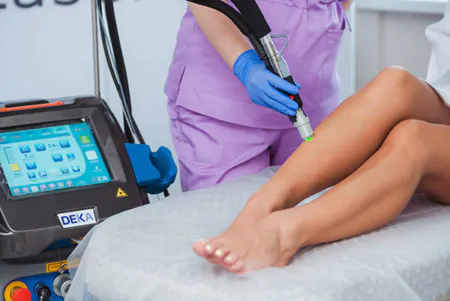 Як прибрати подразнення після лазерної епіляції?