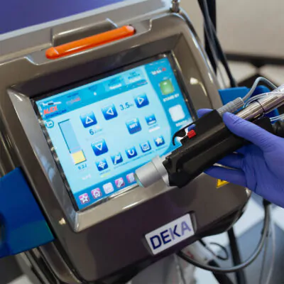 Який лазер краще для епіляції: порівняння сучасних апаратів