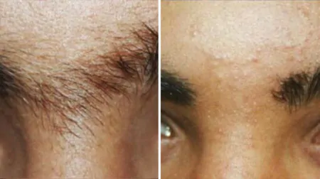 Фото до після: Міжбрів’я