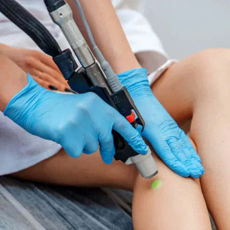 кількість спалахів при лазерній епіляції